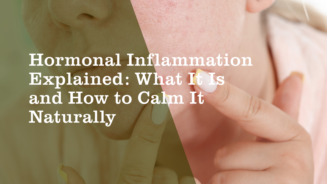 Hormonal Inflammation Explained: What It Is and How to Calm It Naturally