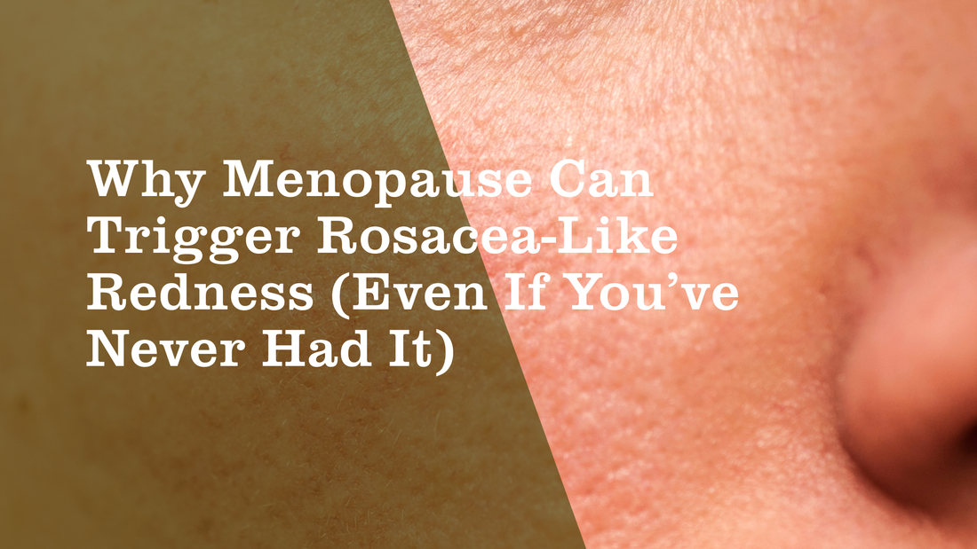 Why Menopause Can Trigger Rosacea-Like Redness (Even If You’ve Never Had It) - Botanical Balance