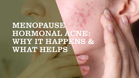 Menopause Hormonal Acne: Why It Happens & What Helps